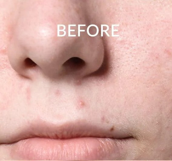 image comparison before