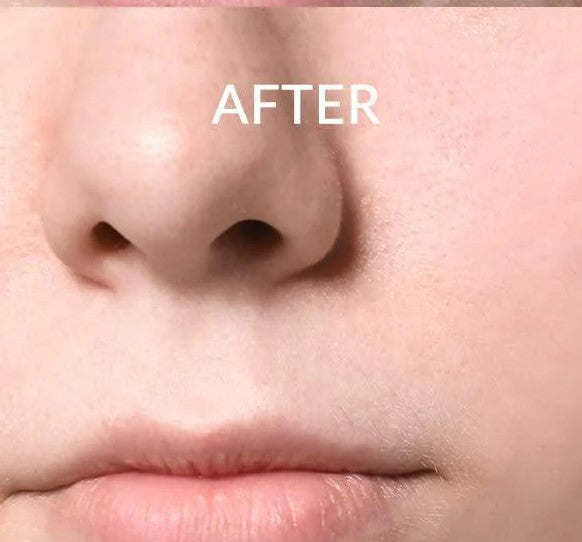 image comparison after